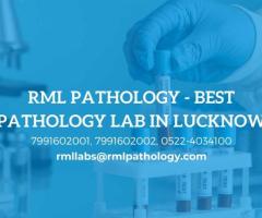 Why RML Pathology is the Best Diagnostic Center in Lucknow – Now Offering NIPS Test