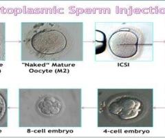 ICSI Treatment Center, ICSI Male Fertility Treatment - Dr. Sudha Tandon's Fertility Center