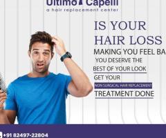 Ultimo Capelli Hair wigs, Hair Patches and Replacement service Bhubaneswar